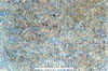 Link to full size image of micrograph 338