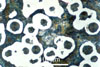 Link to full size image of micrograph 395