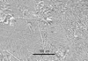 Link to full record for micrograph 760