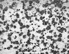 Link to full size image of micrograph 192