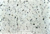 Link to full size image of micrograph 206
