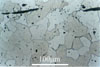 Link to full size image of micrograph 218