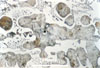 Link to full size image of micrograph 377