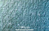 Link to full size image of micrograph 386