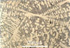 Link to full size image of micrograph 387