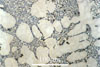 Link to full size image of micrograph 389