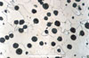 Link to full size image of micrograph 399