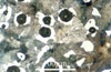 Link to full size image of micrograph 405
