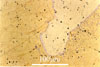 Link to full size image of micrograph 451