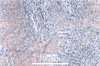 Link to full size image of micrograph 493