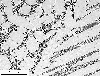 Link to full size image of micrograph 666