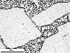 Link to full size image of micrograph 668