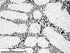 Link to full size image of micrograph 703