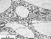 Link to full size image of micrograph 709