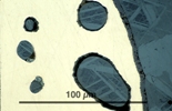 Link to full size image of micrograph 916