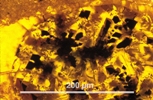 Link to full size image of micrograph 922