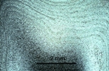 Link to full size image of micrograph 928