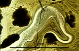 Link to full size image of micrograph 936