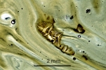 Link to full record for micrograph 962