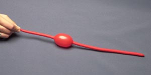 Photograph of balloon with an aneurysm